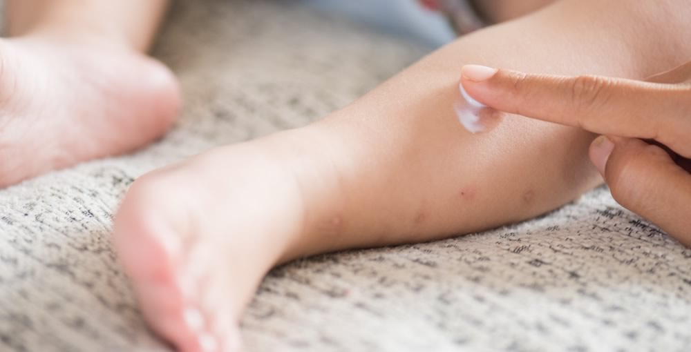 U.S. measles outbreak: Do I need a vaccination? - Texas MedClinic Urgent Care