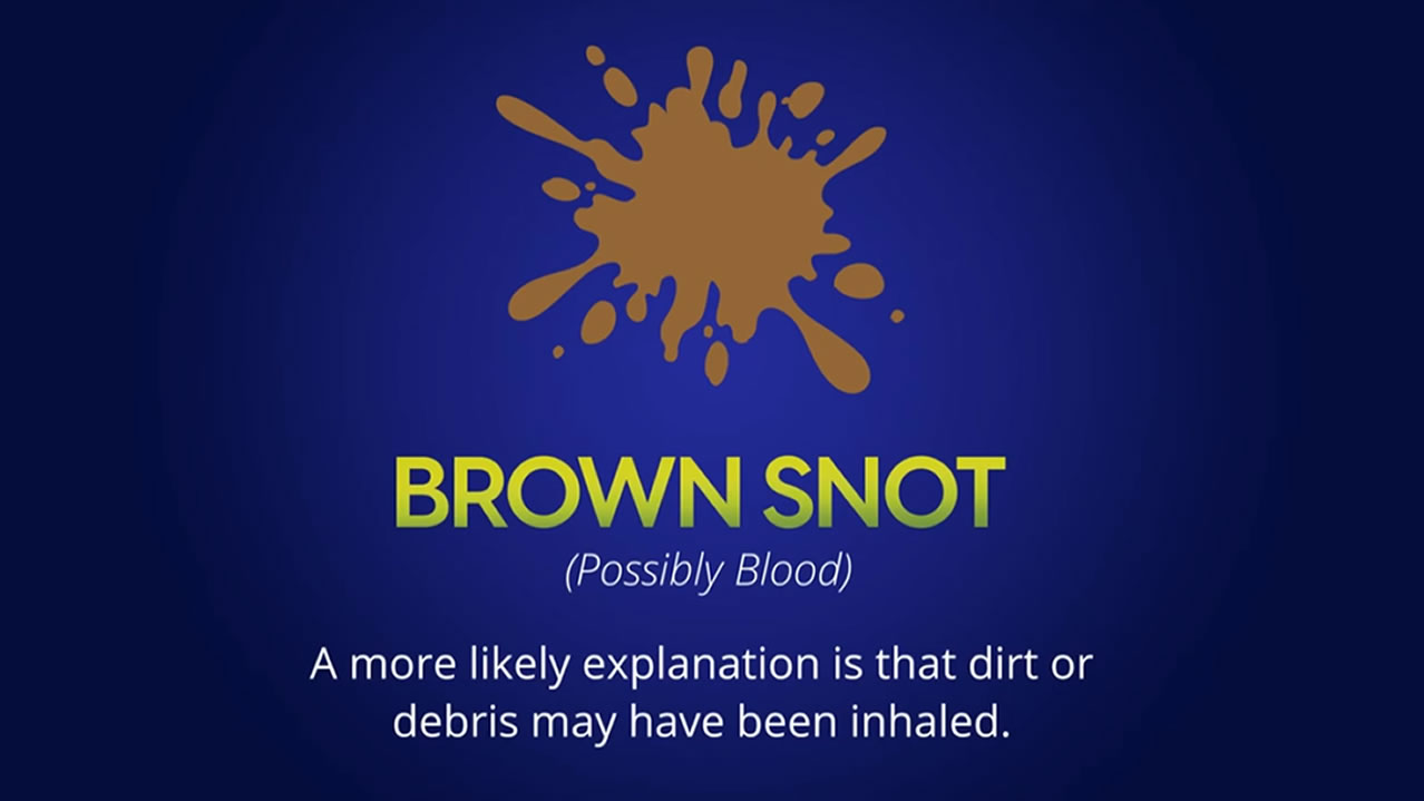 Got brown snot? What is your snot telling you? - Texas MedClinic Urgent Care