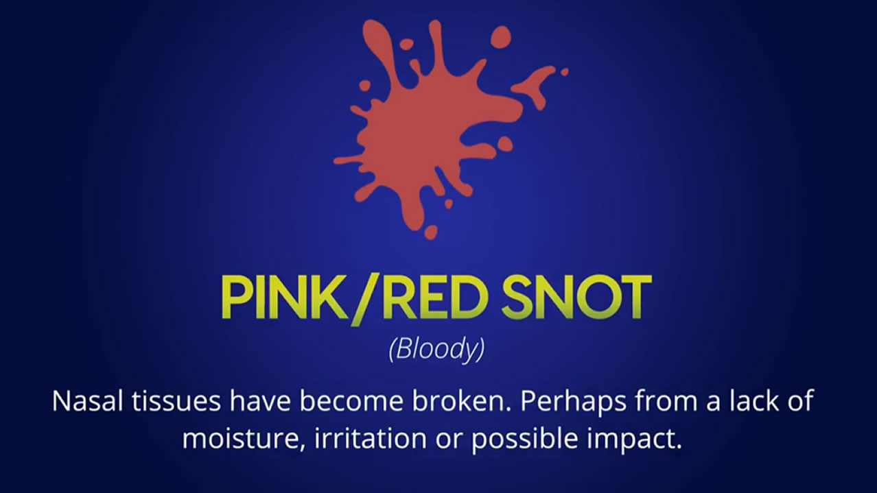 Got pink or red snot? What is your snot telling you? - Texas MedClinic Urgent Care