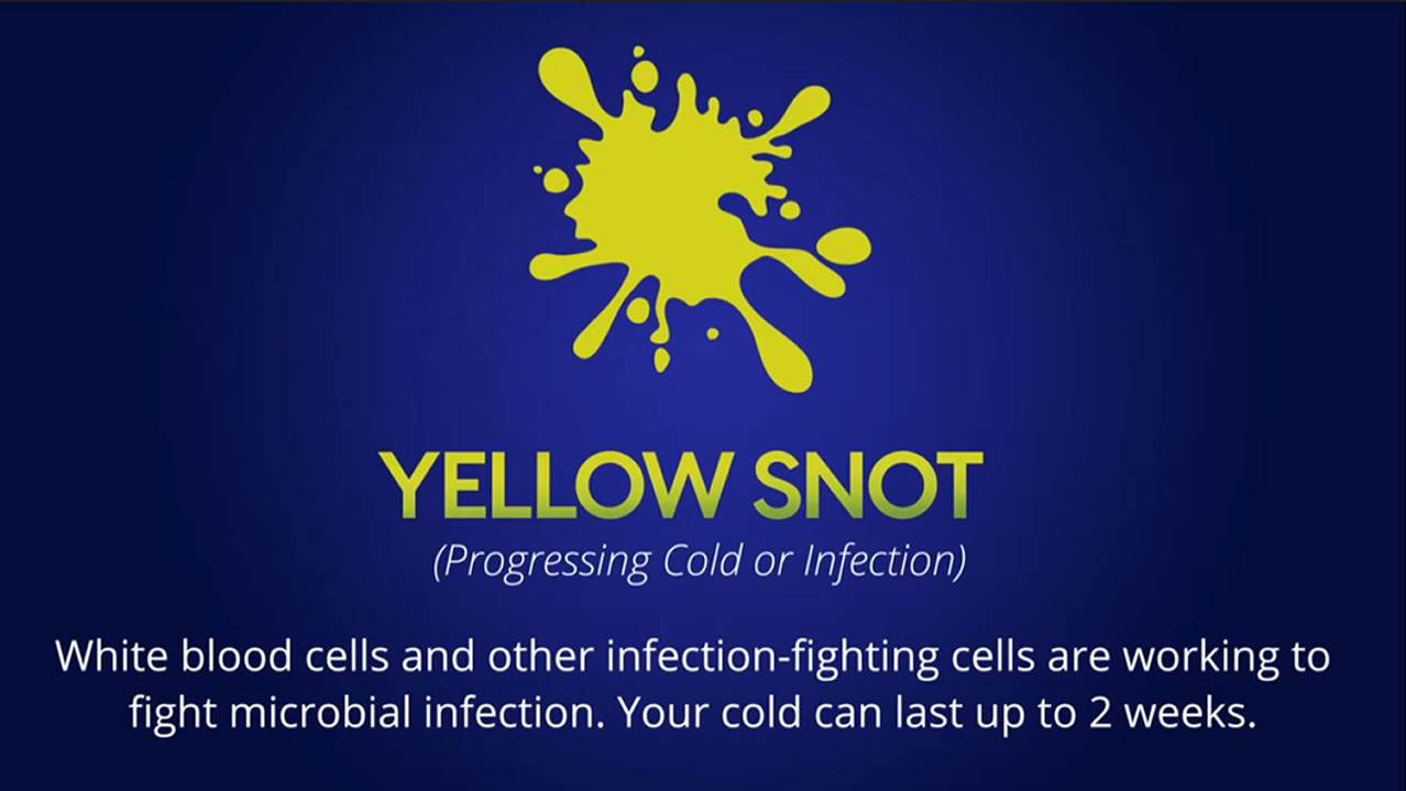 Got yellow snot? What is your snot telling you? - Texas MedClinic Urgent Care