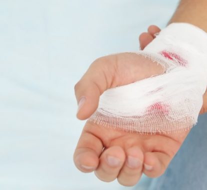 How do you know when a cut needs stitches? - Texas MedClinic