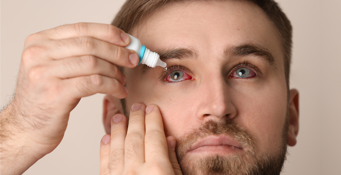 When Pink Eye Requires Urgent Care - Texas MedClinic Urgent Care